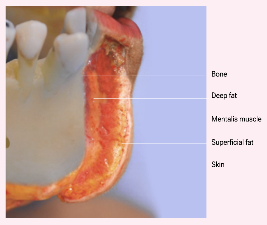 Chin anatomy for cosmetic injectors