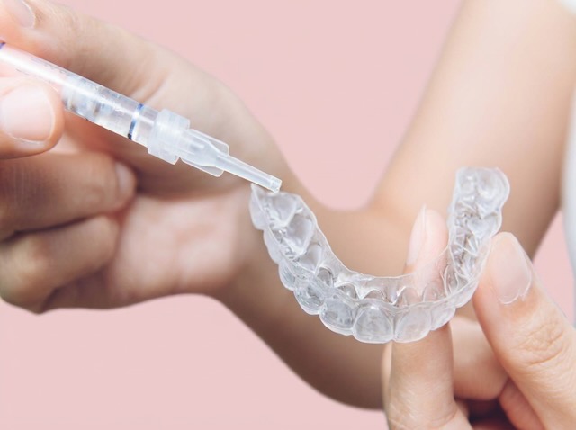 At-home teeth whitening at iDental Balwyn North