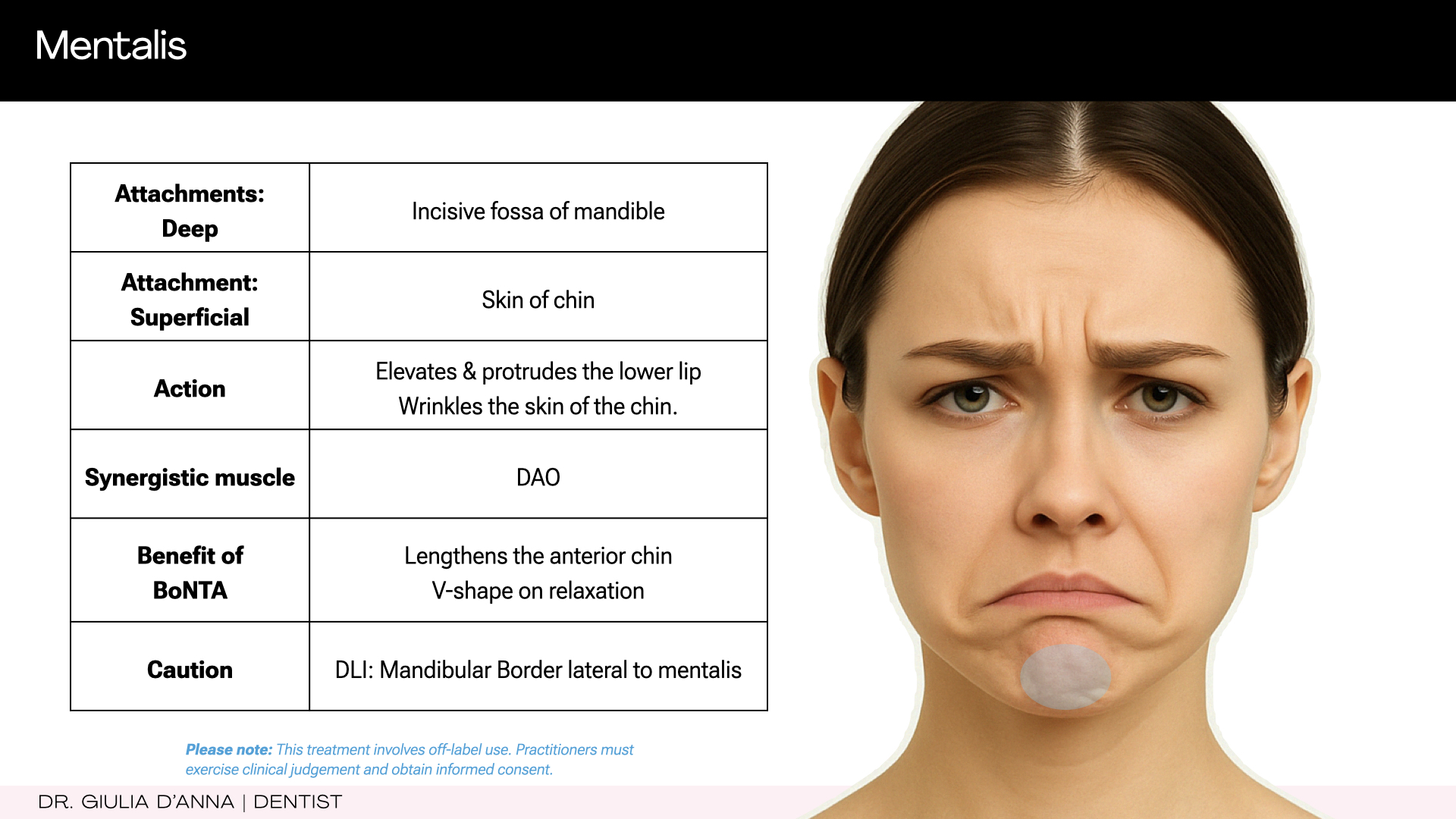 Relationship between the depressor anguli oris and mentalis muscles in the lower face