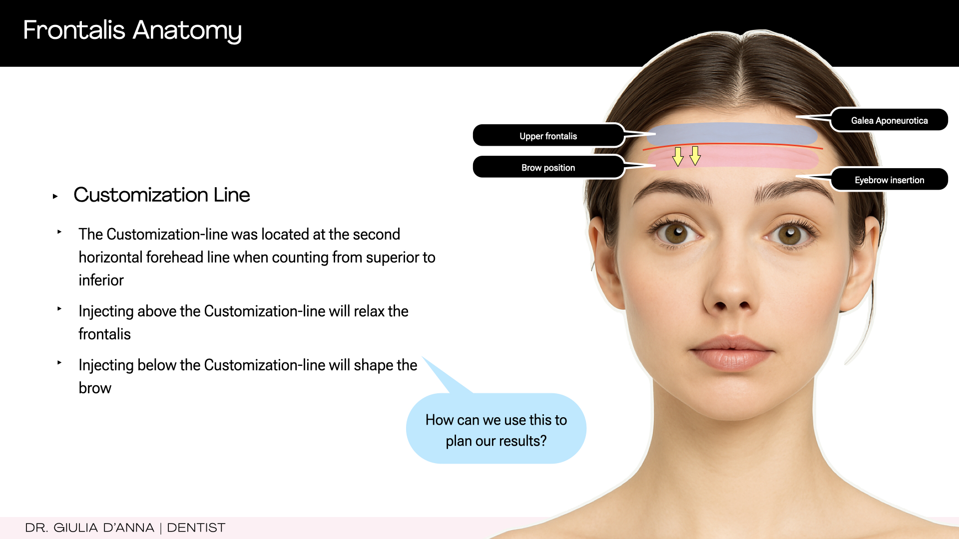 Customisation line demonstrating functional frontalis assessment for botulinum toxin treatment