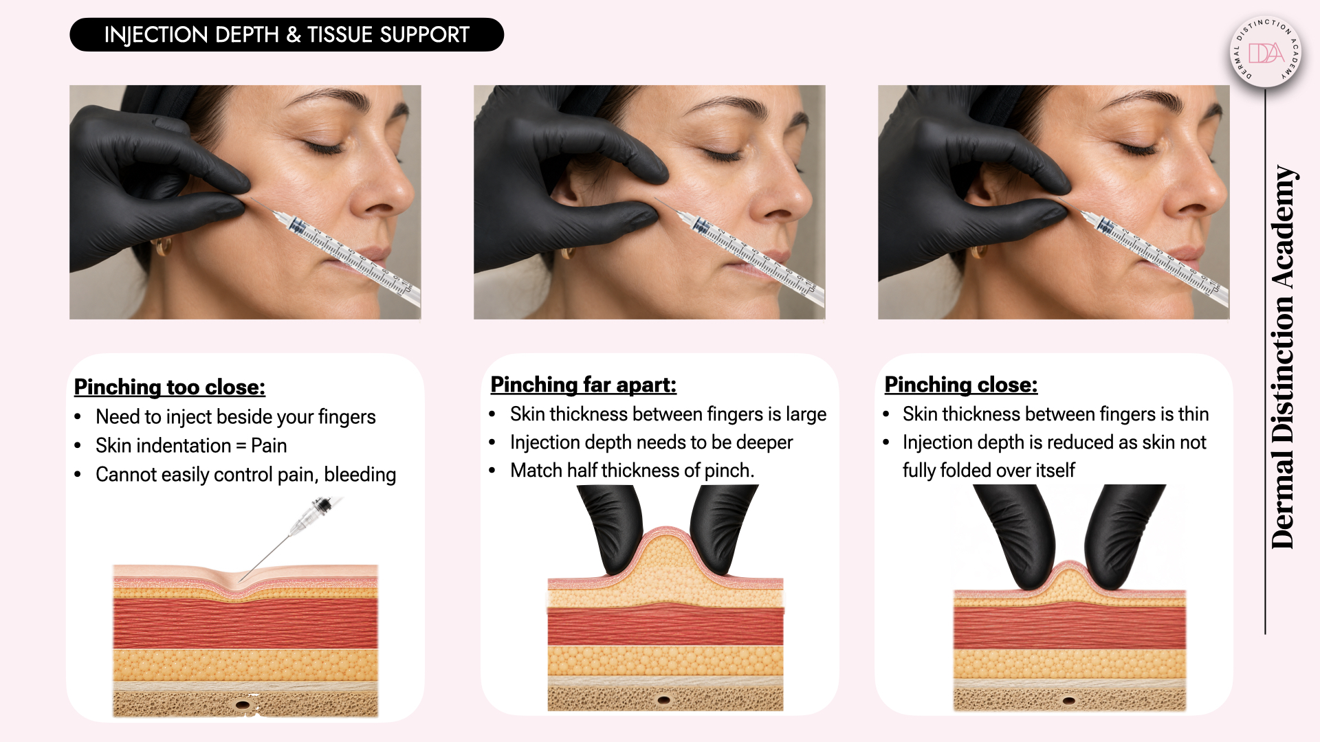 Why depth of injection matters