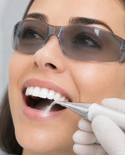 Professional dental cleaning at iDental Balwyn North