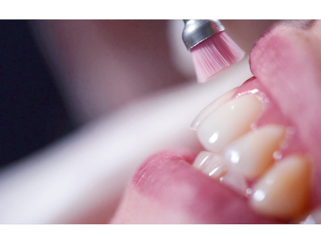Dental assessment and restorative care at iDental Balwyn North